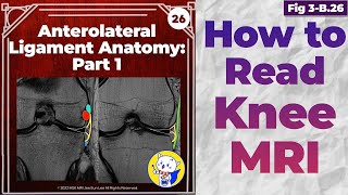 Fig 3B26 Anterolateral Ligament Anatomy [upl. by Sommers]