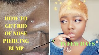 HOW TO GET RID OF NOSE PIERCING BUMP  SUPER FAST AND EASY IN LESS THAN A WEEK [upl. by Pergrim]