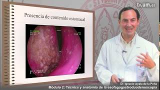 Módulo 2  2 Técnica y anatomía de la esofagogastroduodenoscopia [upl. by Sremmus]