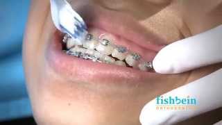 Orthodontic Home Care Instructions  Braces  Brushing [upl. by Ally791]