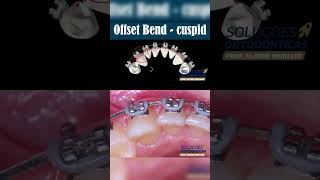 OFFSET BEND  CUSPID  ORTHODONTIC TIPS Shorts [upl. by Ardnuahs]