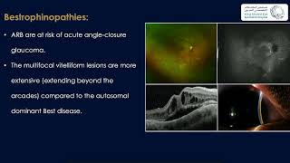 Macular Neovascularization Related to Inherited Retinal Diseases [upl. by Riti]