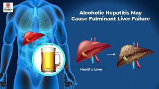 What is Fulminant Hepatitis  Fulminant Hepatic Failure  Hepatitis [upl. by Nohsauq14]