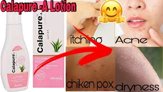 Calapure A Lotion Uses  Calamine Lotion  Review in English [upl. by Ynnaj137]