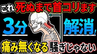 【知って得する】ストレートネックを根本的に改善する方法 [upl. by Moe]