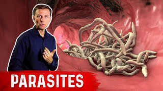 The Best Herbs for Parasites [upl. by Liahus]