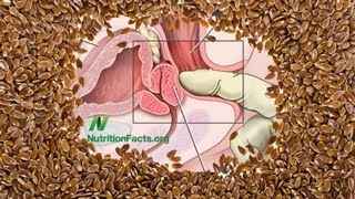 Flaxseed vs Prostate Cancer [upl. by Anitap632]