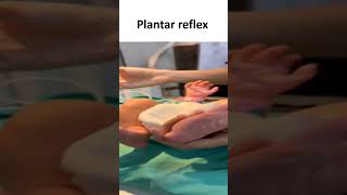 Plantar Reflex [upl. by Truscott]