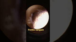 frottis sanguin sous Microscope [upl. by Caye273]