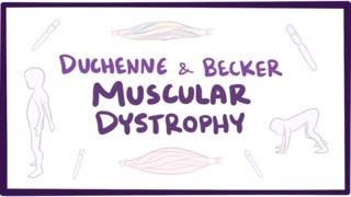 Duchenne amp Becker muscular dystrophy  causes symptoms treatment amp pathology [upl. by Ariadne]