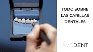 Carillas dentales ¿qué son qué tipos hay y cuándo duran  Clínica dental Avodent [upl. by Bonny]