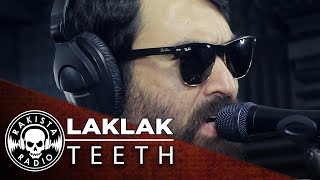 LAKLAK by Teeth  Rakista Live EP148 [upl. by Golanka]