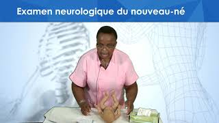 Examen neurologique du nouveau né [upl. by Jemena]