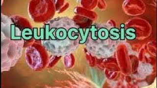 Leukocytosis  Definition of leukocytosis  Type of leukocytosis  Causes of leukocytosis💯 [upl. by Quartus]