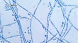 Cladosporium An Indoor Air Quality Contaminant [upl. by Gavrilla]