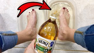 PUT APPLE CIDER VINEGAR ON YOUR FEET AND SEE WHAT HAPPENS 👀😳 [upl. by Edyaw]