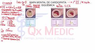 1 CARDIOPATÍA ISQUEMICA 1 [upl. by Neraj824]