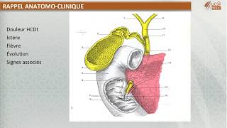 FMPM MOOCs  Radiologie digestive Imagerie des voies biliaires  Pr N Cherif Idrissi El Ganouni [upl. by Ynner176]