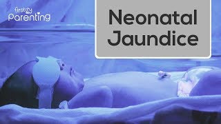 Neonatal Jaundice  Causes Symptoms and Treatment [upl. by Eintirb]