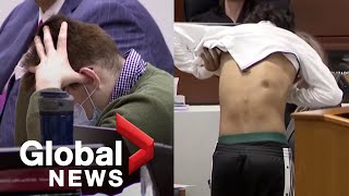 Nikolas Cruz trial Parkland school shooting survivor shows scars from bullet wounds [upl. by Adnilasor531]