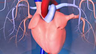 Catheter Ablation What is it and how does it help an irregular heart beat [upl. by Anitsugua]