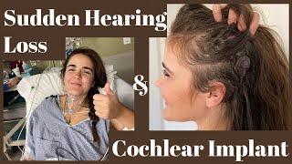 Sudden Hearing Loss Deafness Cochlear Implant Journey [upl. by Durnan597]