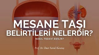 Mesane Taşı Belirtileri Nelerdir Nasıl Tedavi Edilir  Prof Dr Ömer Faruk Karataş [upl. by Yhotmit]