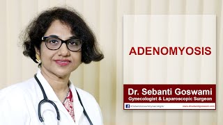 Adenomyosis Symptoms Causes and Treatment  What is Adenomyosis [upl. by Elleivad]