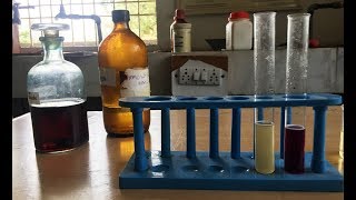 Ketone Bodies in Determination in Urine  Qualitative Urine Analysis  Urine Ketone Bodies  ENGLISH [upl. by Thomasa]