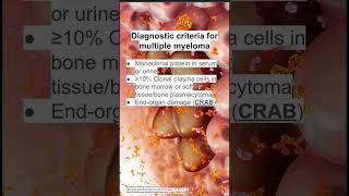 Diagnostic criteria for multiple myeloma [upl. by Simetra726]