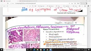 Differentiation and Anaplasia Carcinoma in situ  neoplasia part 2 [upl. by Palumbo]