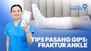 Tips Pasang Gips Fraktur Ankle [upl. by Pearle606]