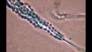 Penicillium cheresanum showing single celled conidia [upl. by Ilyse]