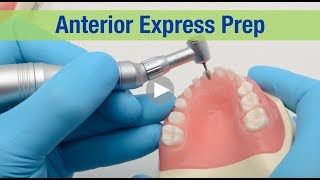 Anterior Express Prep [upl. by Ori]