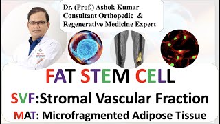 Dr Ashok Kumar Stromal Vascular Fraction SVF Adipose Derived Stem Cell Osteoarthritis [upl. by Coveney]