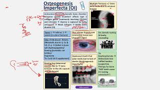 Osteogenesis Imperfecta CBL [upl. by April]