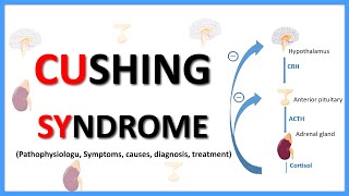 Cushing SyndromeCauses Clinical features Diagnosis Treatment Pathophysiology [upl. by Chrissa98]