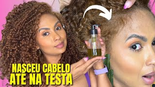 O CABELO CRESCE MUITO E NÃO CAI MELHOR RECEITA DO MUNDO PARA CRESCER CABELO projetorapunzel 🔥 [upl. by Ecilahs]