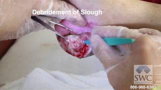 Explanation of Wound Dressings by Skilled Wound Care Dr Bardia Anvar MD [upl. by Sherborne120]