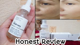 The Ordinary Lactic Acid 10  HA Honest Review  Dark Spots Pigmentation  UrduHindi [upl. by Ttelrahc]