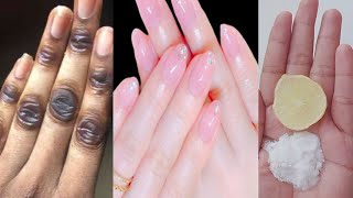 Hand whitening secret home remedies  Hand whitening cream  Manicure at home [upl. by Oicneconi]