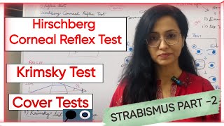 Strabismus Part 2  Hirschberg Corneal Reflex Test  Krimsky Test  Cover Tests [upl. by Ybrad101]