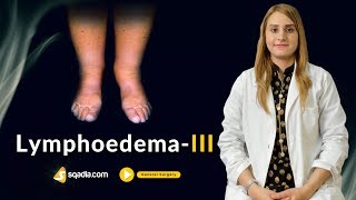 Lymphoedema III  Surgery Video Lectures  Medical Student Online Education  VLearning [upl. by Hachmann]