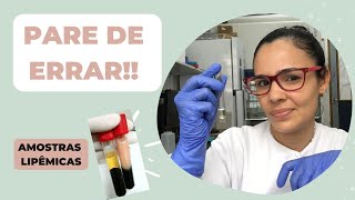 O que fazer com AMOSTRAS LIPÊMICAS  COMO DILUIR JEJUM COMO LER no equipamento [upl. by Annaed]