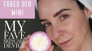 FOREO UFO Mini  Demo  ReviewOMG I love this device [upl. by Naed68]