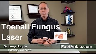 Laser Toenail Treatment  Why You Should NEVER Use Online Coupons by Seattle Podiatrist Dr Huppin [upl. by Dollie340]