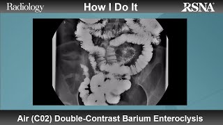 Air C02 DoubleContrast Barium Enteroclysis How I Do It [upl. by Imerej]