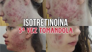 5ª VEZ TOMANDO ISOTRETINOÍNA RoaccutanAccutane  MI EXPERIENCIA  FOTOS del proceso [upl. by Nozicka]