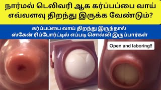 cervix dilation  cervical effacement  cervix dilation chart  cervix dilation symptoms in tamil [upl. by Plossl433]