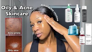 SKINCARE ROUTINE FOR OILY ACNEPRONE SKIN  A routine for smooth amp clear Skin ‼️ [upl. by Marchall]